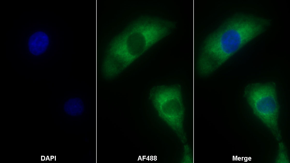 真核翻译延伸因子1δ(EEF1d)多克隆抗体