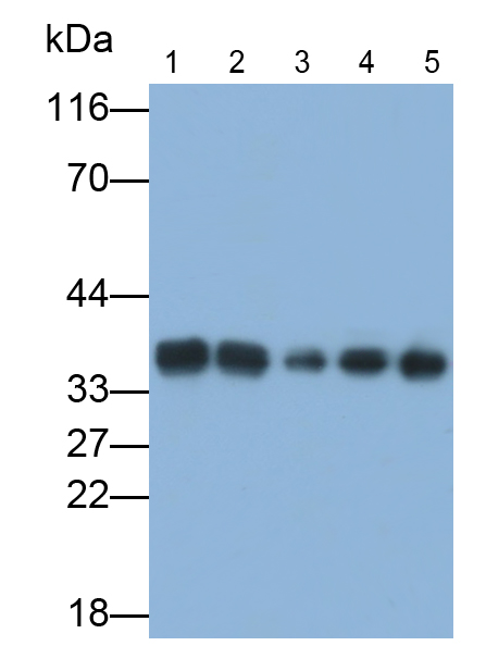 真核翻譯延伸因子1δ(EEF1d)多克隆抗體