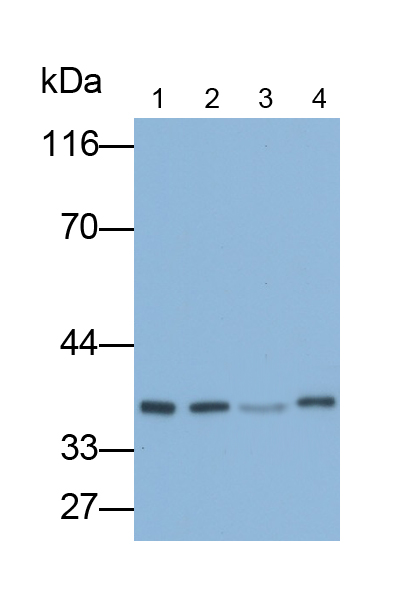 核糖体蛋白L6(RPL6)多克隆抗体