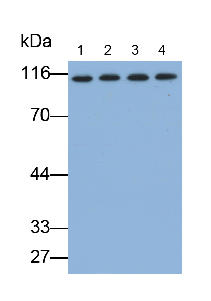 转录中介因子1β(TIF1b)多克隆抗体