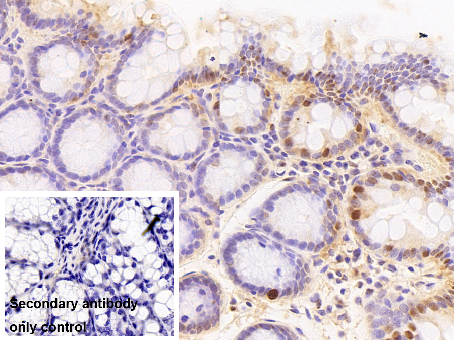 轉錄中介因子1β(TIF1b)多克隆抗體