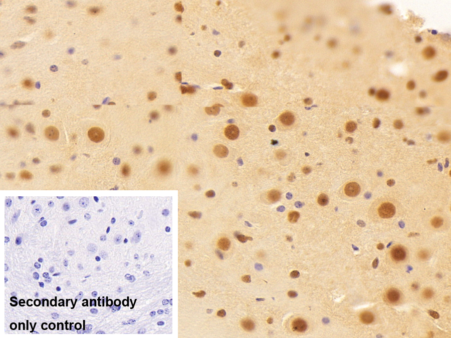 轉錄中介因子1β(TIF1b)多克隆抗體
