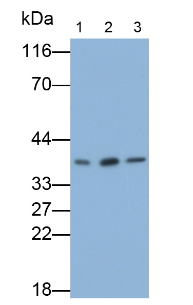 腎母細(xì)胞瘤蛋白1(WT1)多克隆抗體