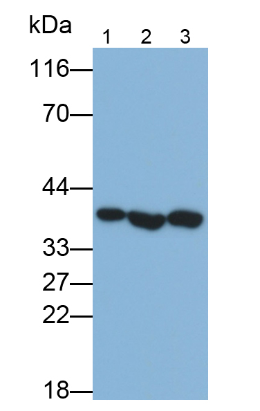 腎母細胞瘤蛋白1(WT1)多克隆抗體