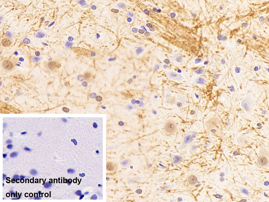不均一核核糖核蛋白K(HNRPK)多克隆抗体