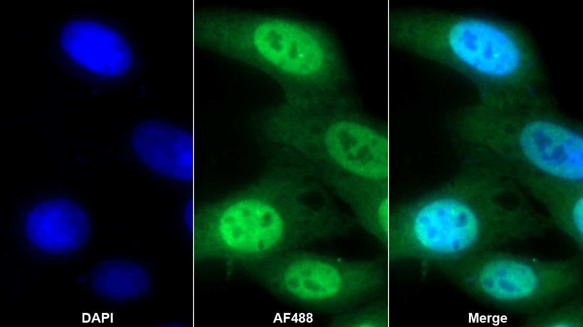 不均一核核糖核蛋白K(HNRPK)多克隆抗体