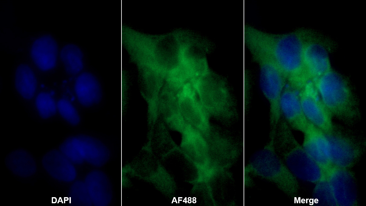 17-β-羥基類固醇脫氫酶12(HSD17b12)多克隆抗體