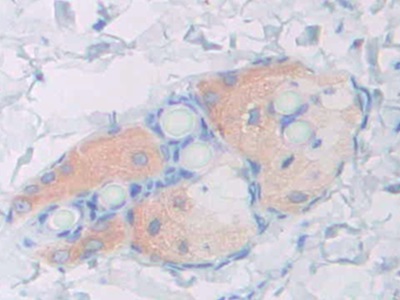 17-β-羥基類(lèi)固醇脫氫酶12(HSD17b12)多克隆抗體