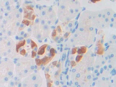 17-β-羥基類(lèi)固醇脫氫酶12(HSD17b12)多克隆抗體