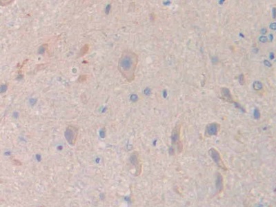 17-β-羥基類(lèi)固醇脫氫酶12(HSD17b12)多克隆抗體
