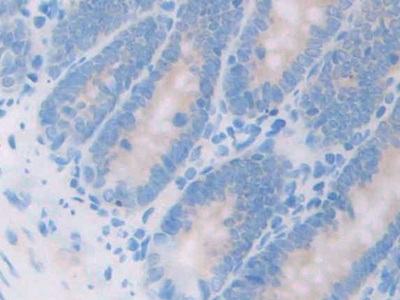17-β-羥基類(lèi)固醇脫氫酶12(HSD17b12)多克隆抗體