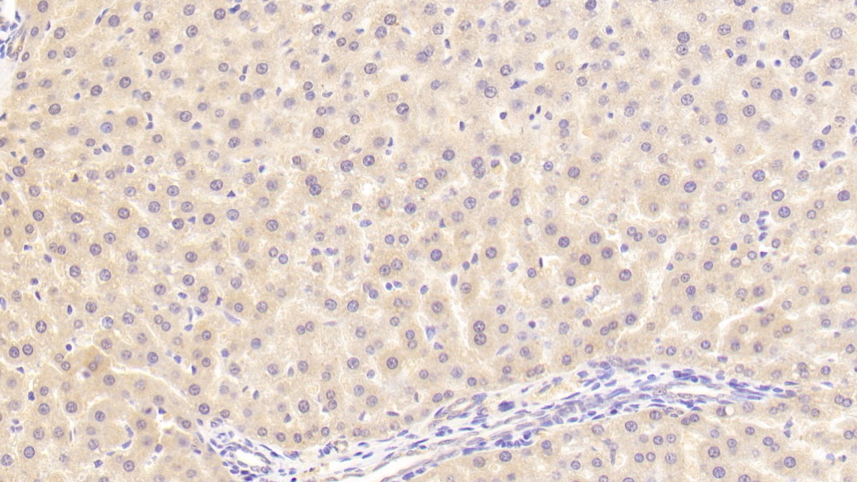 17-β-羥基類(lèi)固醇脫氫酶12(HSD17b12)多克隆抗體