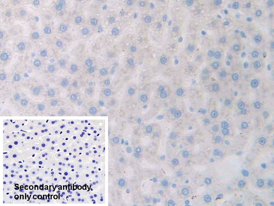 17-β-羥基類(lèi)固醇脫氫酶12(HSD17b12)多克隆抗體