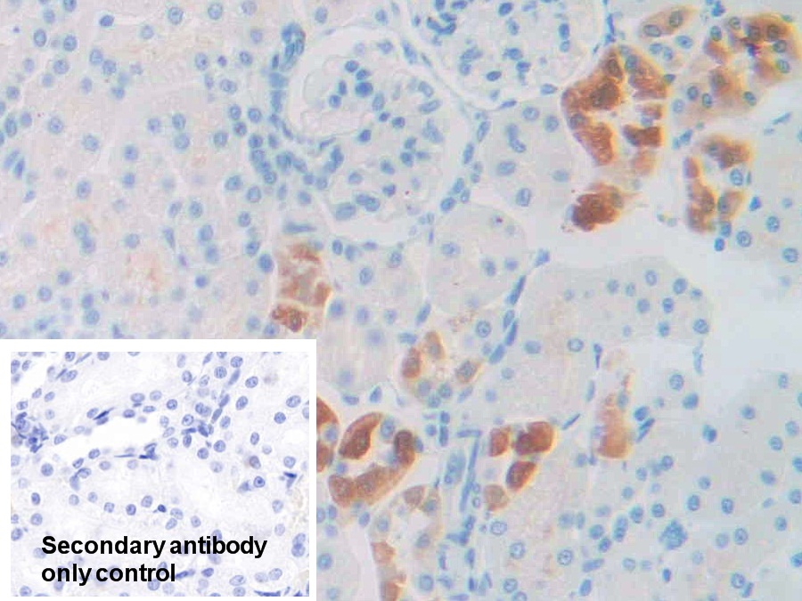 17-β-羥基類(lèi)固醇脫氫酶12(HSD17b12)多克隆抗體