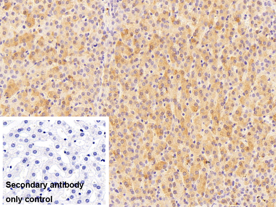 羧酸酯酶3(CES3)多克隆抗體