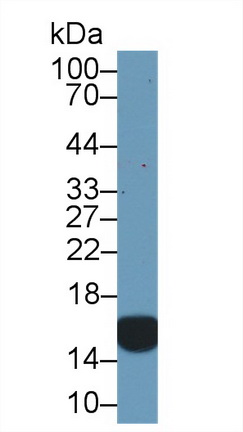 细胞维甲酸结合蛋白2(CRABP2)多克隆抗体