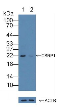 半胱氨酸甘氨酸丰富蛋白1(CSRP1)多克隆抗体