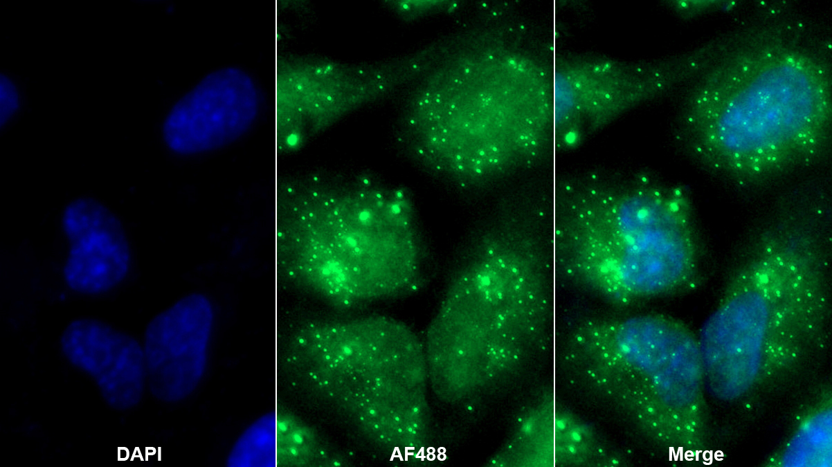 晶狀體蛋白βB2(CRYbB2)多克隆抗體
