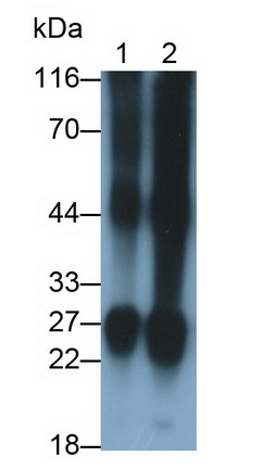 晶狀體蛋白βB2(CRYbB2)多克隆抗體