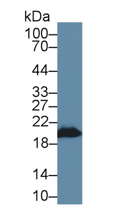 热休克蛋白β6(HSPb6)多克隆抗体