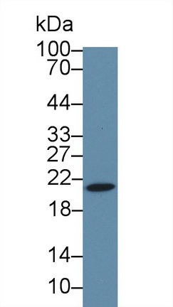 热休克蛋白β6(HSPb6)多克隆抗体