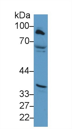 肉毒堿棕櫚?；D(zhuǎn)移酶1A(CPT1A)多克隆抗體
