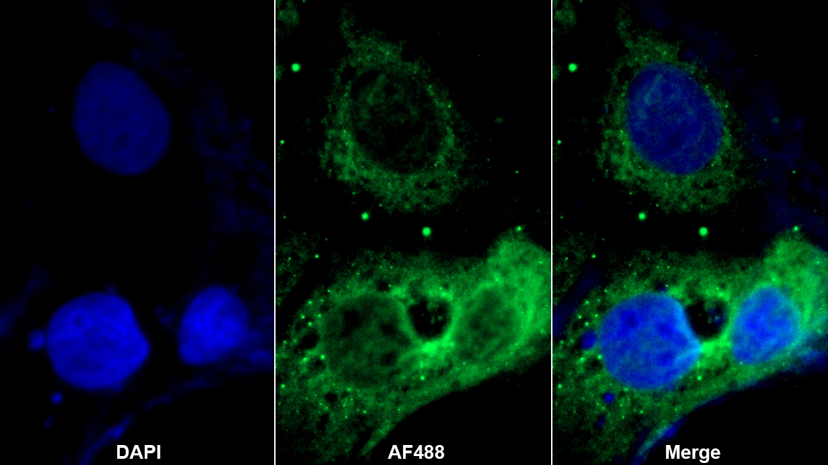 脊椎蛋白1(SPON1)多克隆抗體