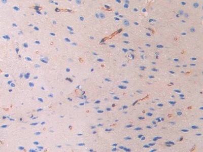 衰老關(guān)鍵蛋白4(FBLN4)多克隆抗體