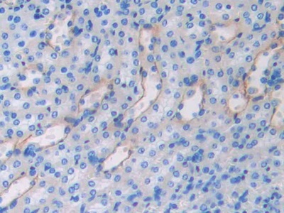 衰老關(guān)鍵蛋白4(FBLN4)多克隆抗體