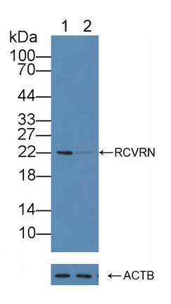 恢復蛋白(RCVRN)多克隆抗體