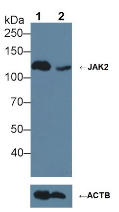 Janus激酶2(JAK2)多克隆抗体