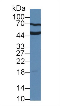 尿溶蛋白3A(UPK3A)多克隆抗体