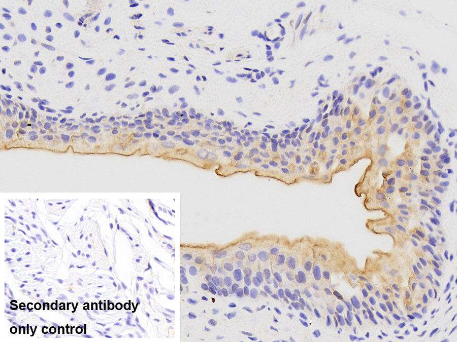 尿溶蛋白3B(UPK3B)多克隆抗体