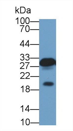 囊泡关联膜蛋白关联蛋白A(VAPA)多克隆抗体