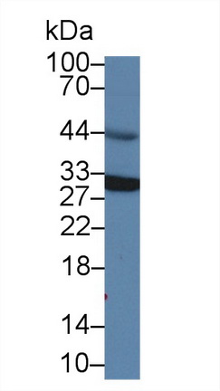 囊泡关联膜蛋白关联蛋白A(VAPA)多克隆抗体