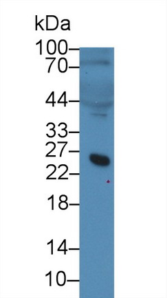 微纤丝关联蛋白5(MFAP5)多克隆抗体