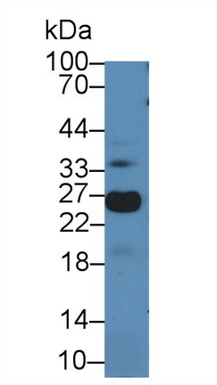 微纤丝关联蛋白5(MFAP5)多克隆抗体