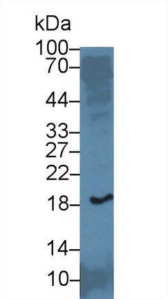 微纖絲關(guān)聯(lián)蛋白5(MFAP5)多克隆抗體
