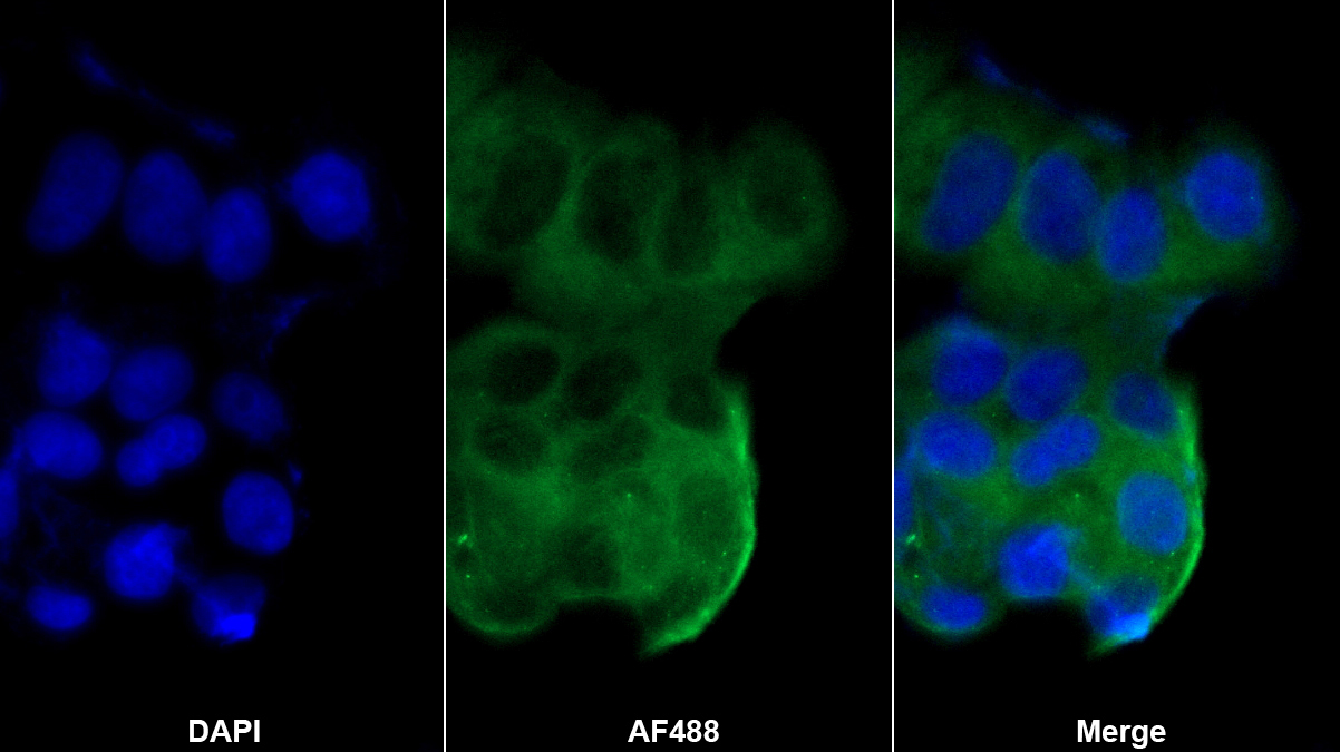 肽基精氨酸脫亞氨酶Ⅲ(PADI3)多克隆抗體
