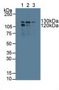 DNA指导聚合酶γ1(POLg1)多克隆抗体