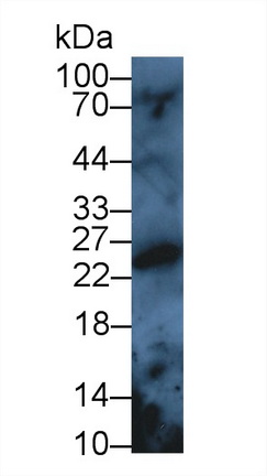 过氧化还原酶3(PRDX3)多克隆抗体