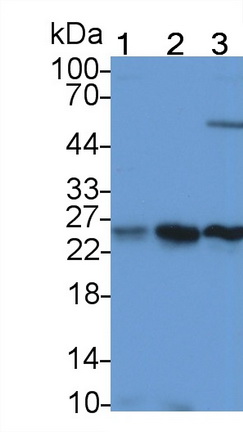过氧化还原酶3(PRDX3)多克隆抗体