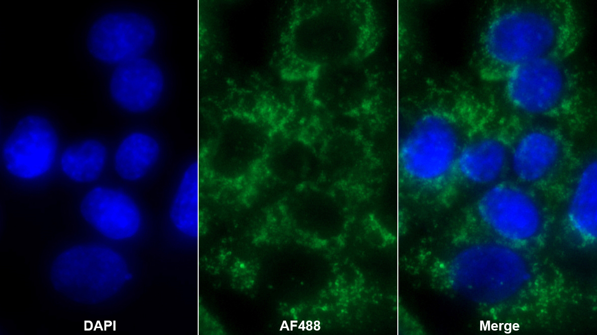 過氧化還原酶3(PRDX3)多克隆抗體