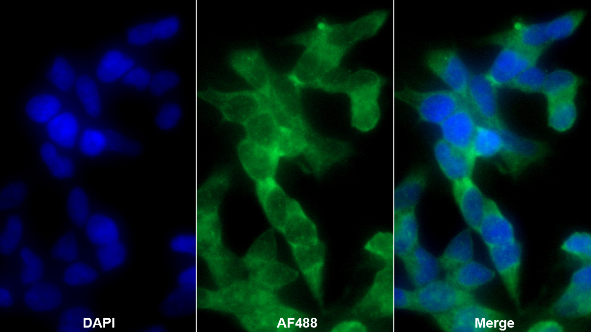 胞裂蛋白6(SEPT6)多克隆抗體