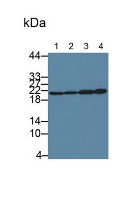 S-期激酶关联蛋白1(SKP1)多克隆抗体