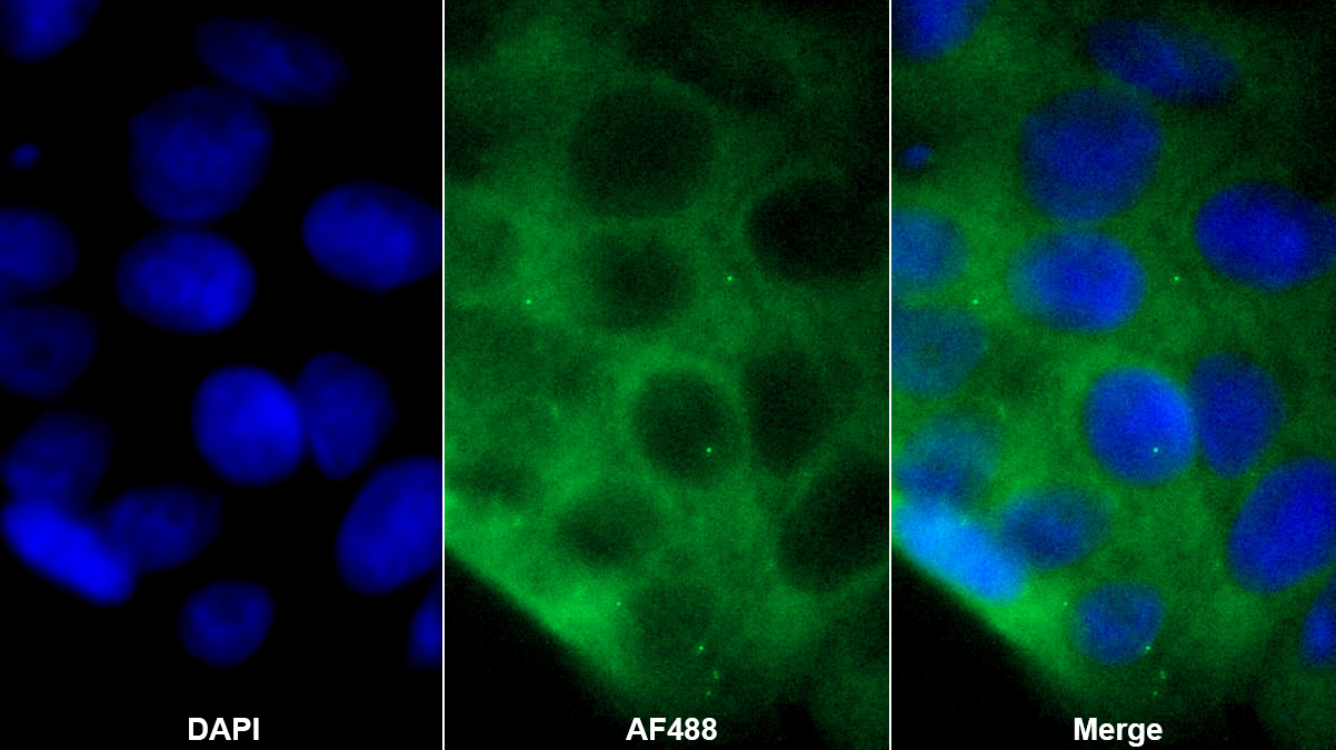 S-期激酶關聯(lián)蛋白1(SKP1)多克隆抗體