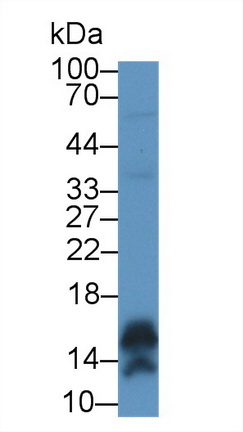 钙调蛋白样蛋白5(CALML5)多克隆抗体