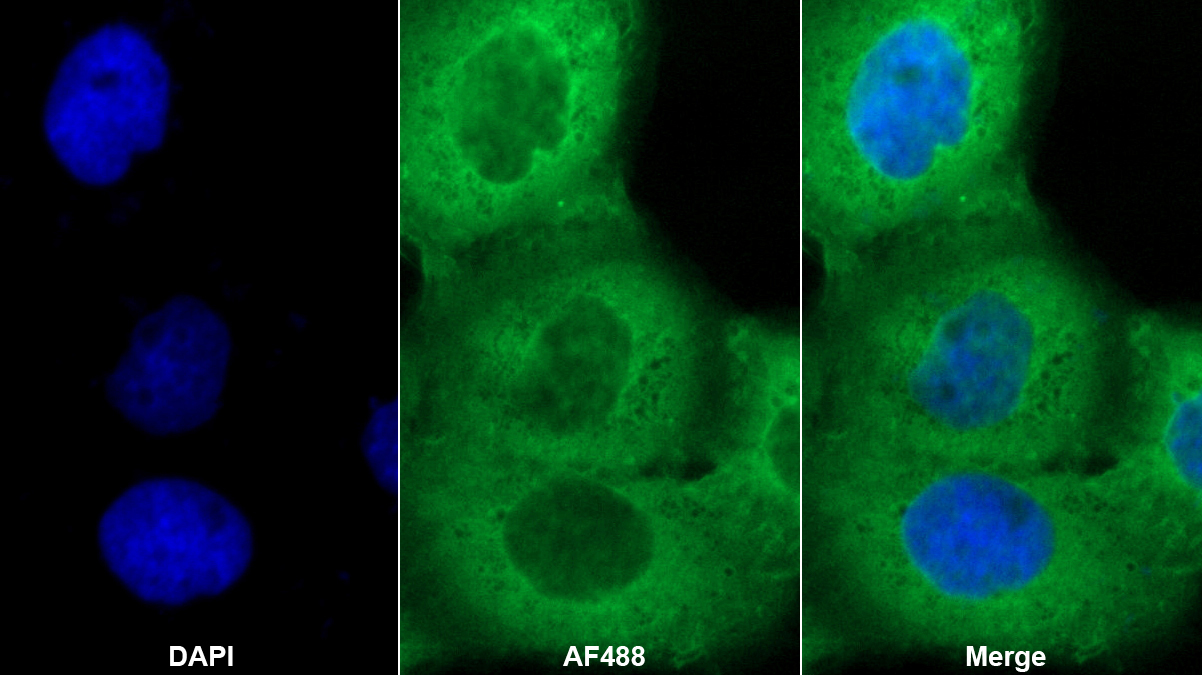 钙调蛋白样蛋白5(CALML5)多克隆抗体