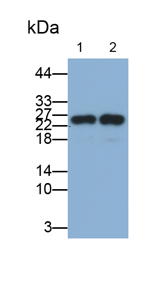 胞漿磷蛋白2(STMN2)多克隆抗體