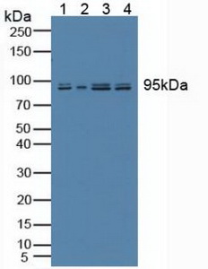 核膜含血影蛋白重复蛋白2(Nesp2)多克隆抗体
